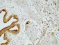 Cox-2 Polyclonal Antibody